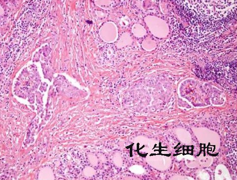 颈管细胞有,化生细胞有是什么意思