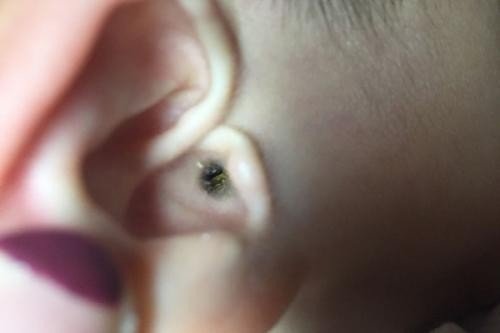 吃了耳屎真的会变成哑巴吗?