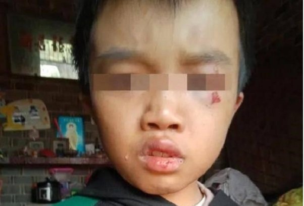 江西12岁男童家中惨死，母亲整日牌场潇洒，爷爷为何认定是被打死的？