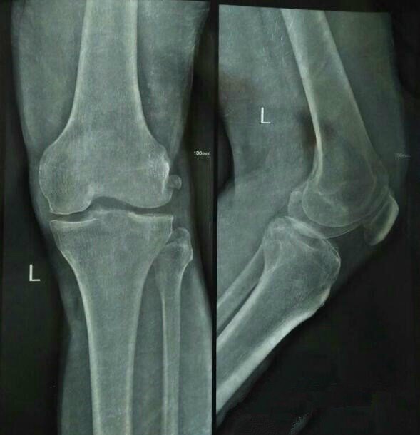 乌珠军马贴效果怎么样？