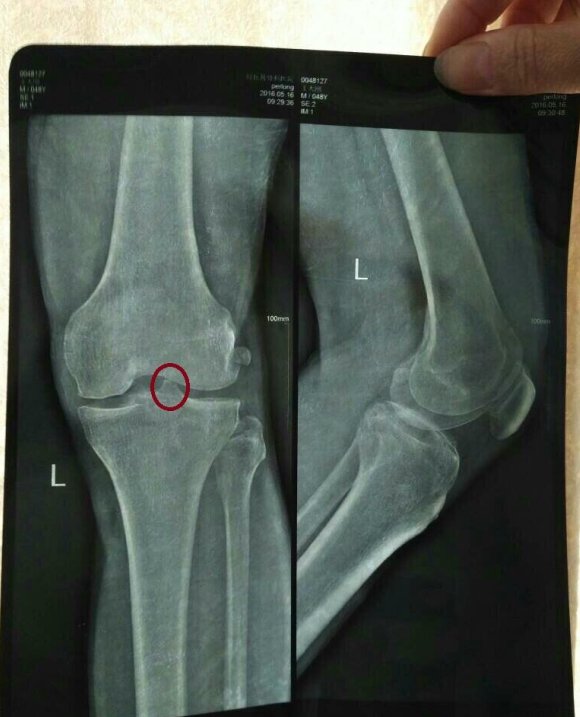 乌珠军马贴效果怎么样？