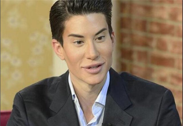 那个为追求完美，花154万在背上植入“翅膀”的小伙，现状如何？