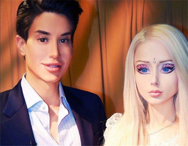 那个为追求完美，花154万在背上植入“翅膀”的小伙，现状如何？