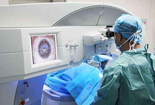 近视激光大概需要多少钱？