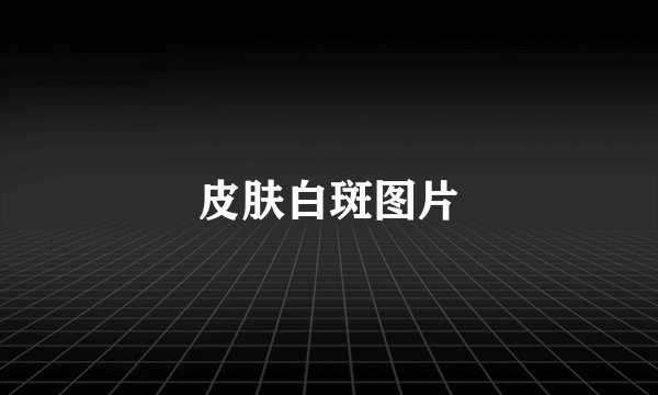 皮肤白斑图片