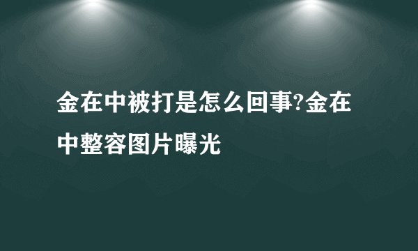 金在中被打是怎么回事?金在中整容图片曝光