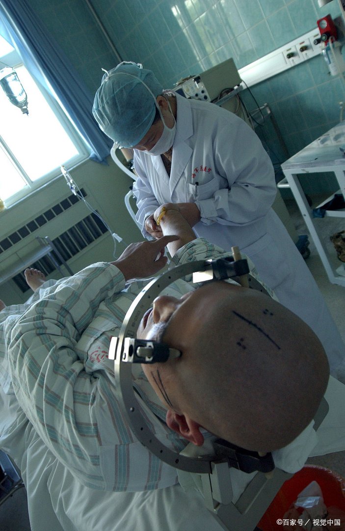 为什么开颅之后人就不能活动不能言语呢