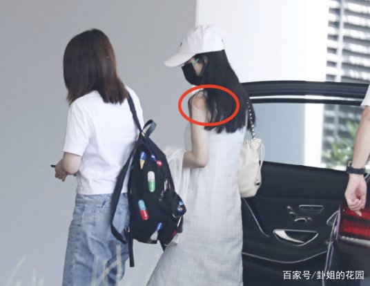 赵丽颖现身机场一脸疲惫，身上竟出现拔火罐的印记，这是怎么了？