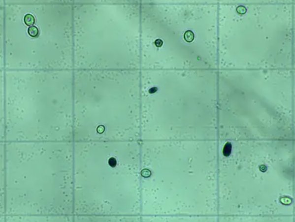 培养液中酵母菌种群数量变化实验是什么？