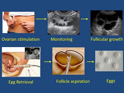 试管婴儿中胚胎跟囊胎啥意思