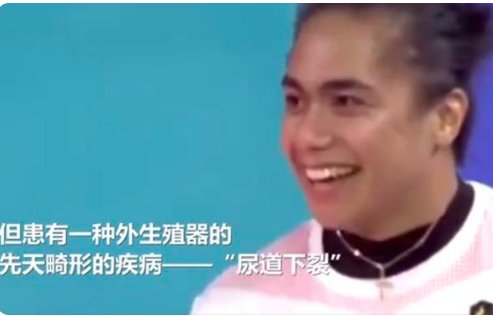 印尼知名女运动员被确认为男性，他做矫正手术了吗？