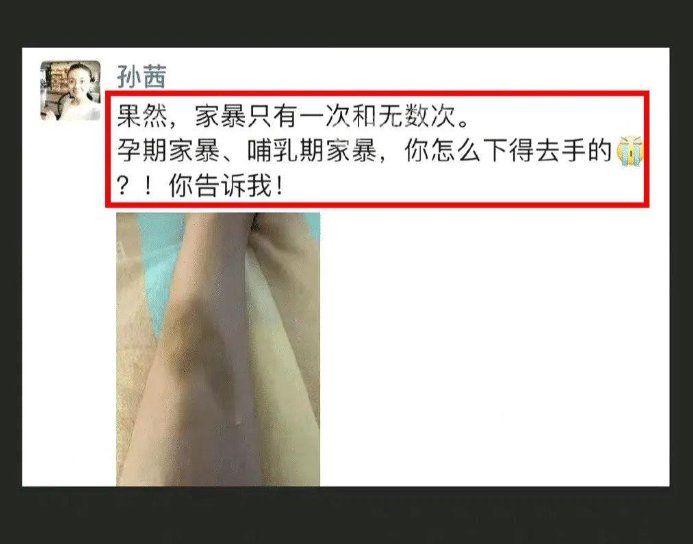 孙茜否认被家暴：非本人，想警示施暴者停止伤害，孙茜出演过哪些电视剧？