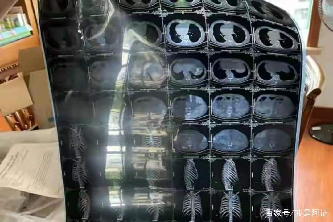 上海夫妻为报复邻居连开五年震楼器，到底什么仇什么怨？