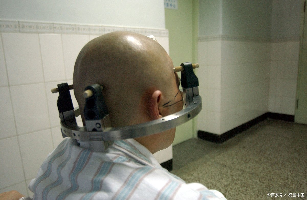 为什么开颅之后人就不能活动不能言语呢