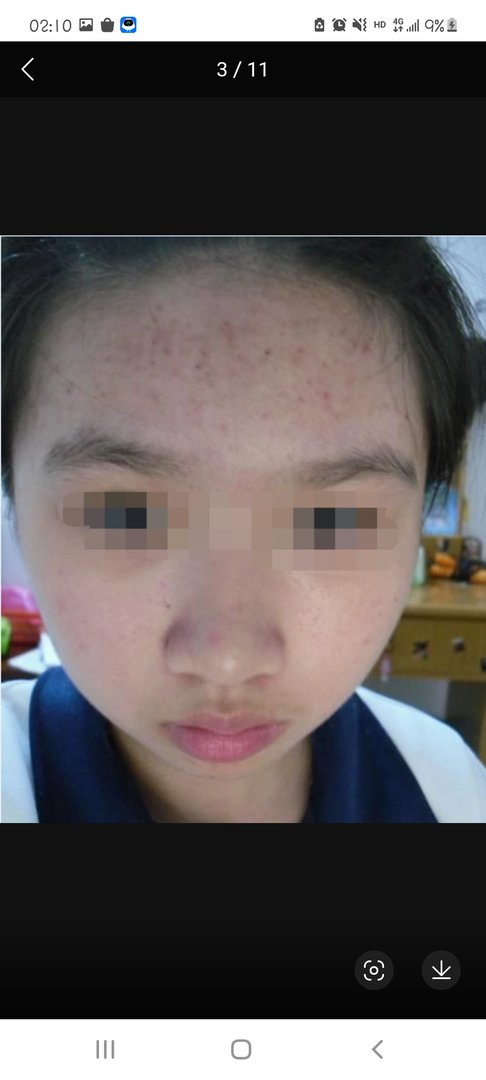 你觉得苗医生祛痘流程专业吗？