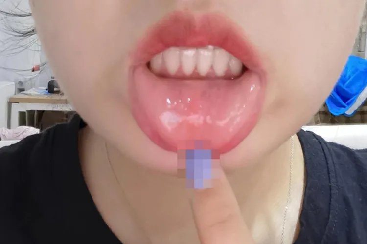 正常人的嘴唇里是什么样图片