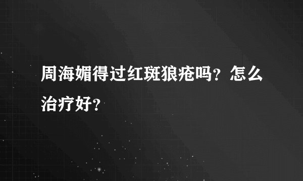 周海媚得过红斑狼疮吗？怎么治疗好？