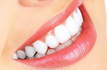 成都牙齿美白价格