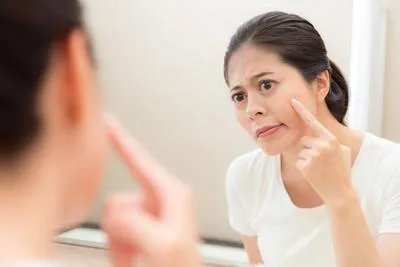 白醋真的能去痘印吗