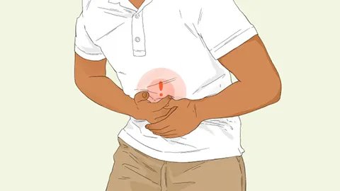 贲门疾病应该怎么治疗