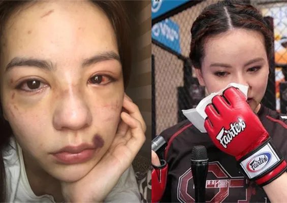 港姐被打成猪头惨不忍睹 宣布退出娱乐圈转行做生意