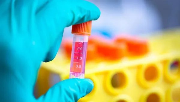 上海1阳性人员为逃管控翻墙外出被立案,他给当地抗击疫情带来了哪些麻烦?