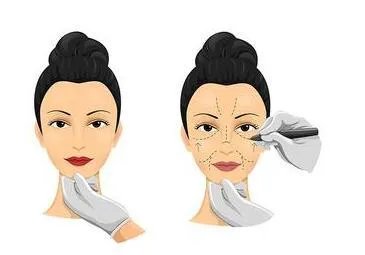 整形美容医院价格