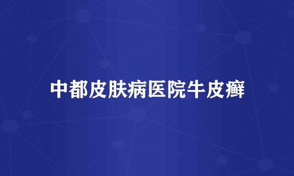 中都皮肤病医院牛皮癣