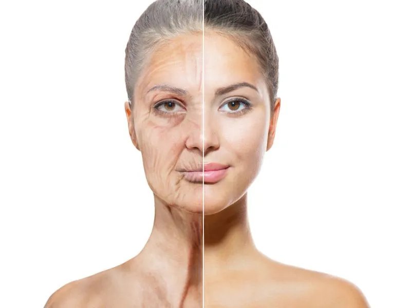 注射除鱼尾纹的方法