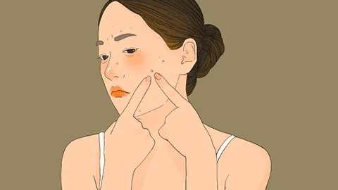 快速去痘印的方法