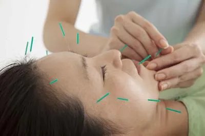 痤疮疤痕专科医院 痤疮疤痕的表现症状