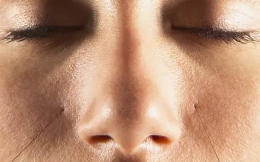 鼻孔缩小整形副作用