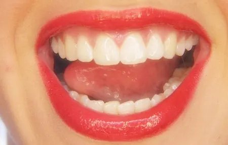 上海种植牙大概多少钱