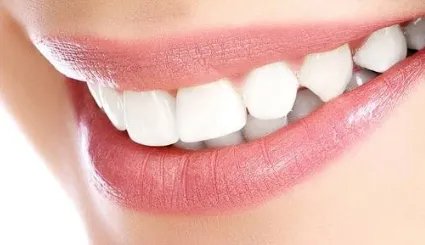 贵金属烤瓷牙价格是多少