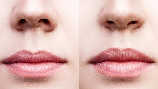 鼻头太大怎么办