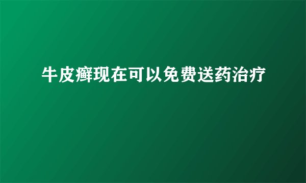 牛皮癣现在可以免费送药治疗