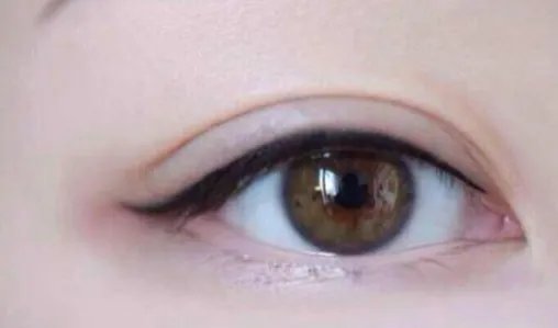 做韩式开眼角比较好的医院