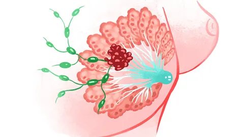 乳腺血氧检查怎么做