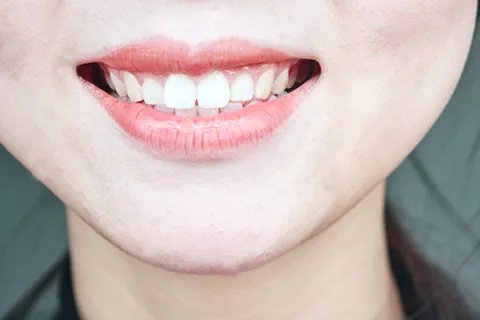 种牙费用是多少