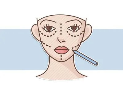 韩国曝幽灵整容数百人丧命:被整形毁掉的中国女孩,还有多少?