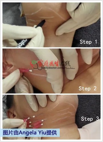 带你到香港寻找微整形新概念