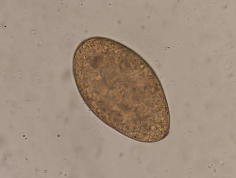 蛔虫病传播途径