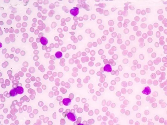 第二代头孢菌素的作用与功效