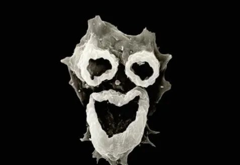 福氏耐格里变形虫有什么危害？