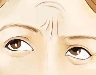 抬头纹手术价格是多少钱