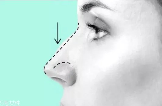 伊婉c是中分子吗 伊婉玻尿酸真假对比图片