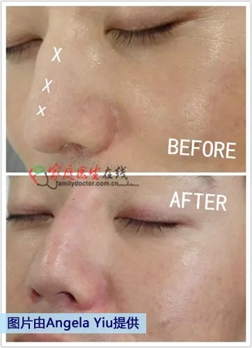 带你到香港寻找微整形新概念