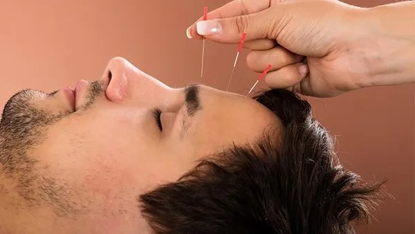 中医针灸减肥效果好不好？这些针灸减肥的原理要了解