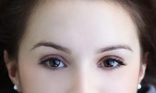 额头窄丰额头多少钱