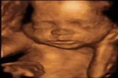 胎儿的四维彩超图片